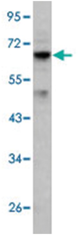 RIOK1 Rabbit anti-Human, Polyclonal Antibody, Abnova 400&mu;L; Unlabeled:Antibodies,