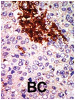RIOK1 Rabbit anti-Human, Polyclonal Antibody, Abnova 400&mu;L; Unlabeled:Antibodies,