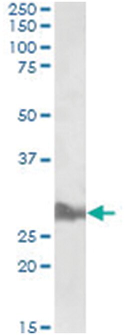 APOA1, Goat, Polyclonal Antibody, Abnova 100 &mu;g | Buy Online | Abnova Corporation | Fisher Scientific
