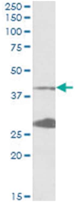 UROD, Goat, Polyclonal Antibody, Abnova 100&mu;g; Unlabeled:Antibodies,