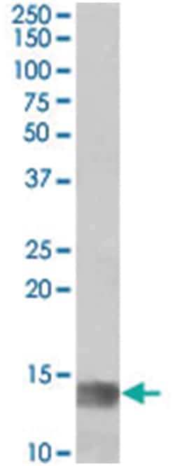 MIA, Goat, Polyclonal Antibody, Abnova 100&mu;g; Unlabeled:Antibodies,