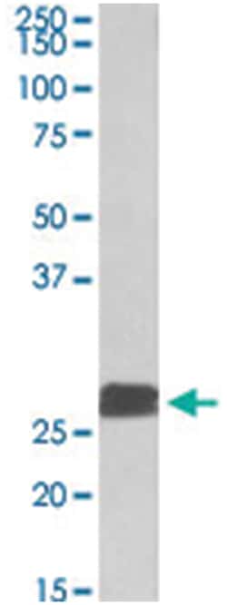 DUSP6, Goat, Polyclonal Antibody, Abnova 100 &mu;g | Buy Online | Abnova Corporation | Fisher Scientific