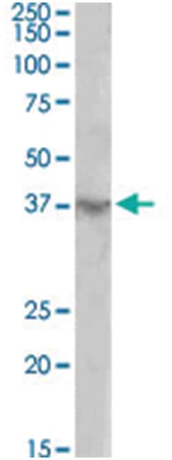 HOXD12, Goat, Polyclonal Antibody, Abnova 100 &mu;g | Buy Online | Abnova | Fisher Scientific