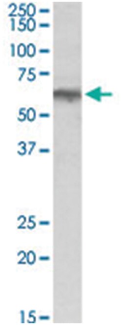 ADRA1B Goat anti-Chicken, Dog, Human, Mouse, Pig, Rat, Polyclonal Antibody, Abnova 100 &mu;g | Buy Online | Abnova Corporation | Fisher Scientific