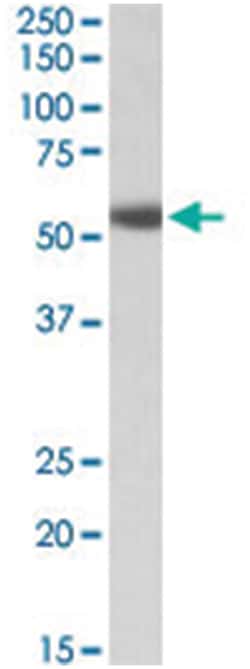 ADRA1A, Goat, Polyclonal Antibody, Abnova 100 &mu;g | Buy Online | Abnova Corporation | Fisher Scientific