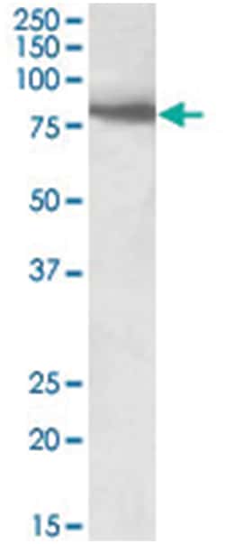 BBS7, Goat, Polyclonal Antibody, Abnova 100 &mu;g | Buy Online | Abnova Corporation | Fisher Scientific