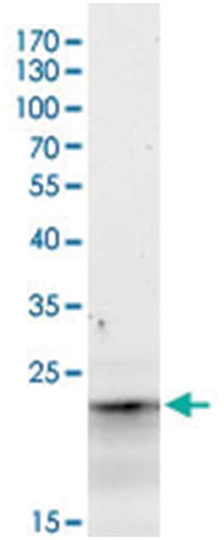 HSP31, Goat, Polyclonal Antibody, Abnova 100 &mu;g | Buy Online | Abnova Corporation | Fisher Scientific