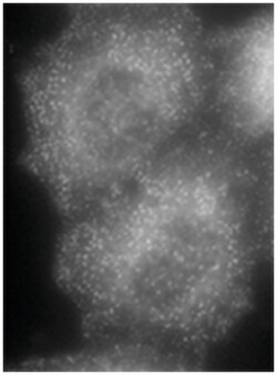 AP2A1 Goat anti-Chicken, Human, Mouse, Pig, Rat, Polyclonal Antibody, Abnova 100 &mu;g | Buy Online | Abnova Corporation | Fisher Scientific