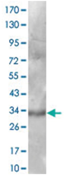 Cd97, Goat, Polyclonal Antibody, Abnova 100 &mu;g | Buy Online | Abnova Corporation | Fisher Scientific