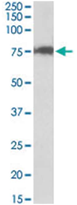 CSTF3, Goat, Polyclonal Antibody, Abnova 100 &mu;g | Buy Online | Abnova | Fisher Scientific