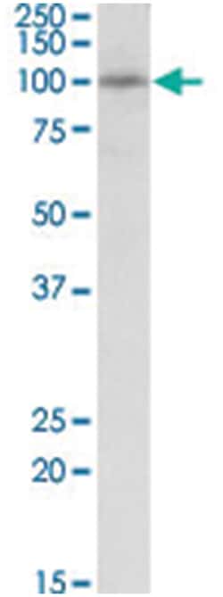 PEX6, Goat, Polyclonal Antibody, Abnova 100 &mu;g | Buy Online | Abnova Corporation | Fisher Scientific