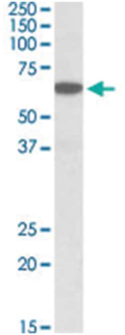 PLA2G4C, Goat, Polyclonal Antibody, Abnova 100μg; Unlabeled:Antibodies,