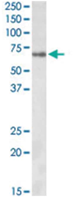 Zfp157, Goat, Polyclonal Antibody, Abnova 100&mu;g; Unlabeled:Antibodies,
