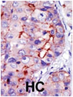 CAMK1D Rabbit anti-Human, Polyclonal Antibody, Abnova 400&mu;L; Unlabeled:Antibodies,