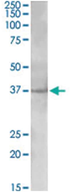 PLK5P, Goat, Polyclonal Antibody, Abnova 100 &mu;g | Buy Online | Abnova Corporation | Fisher Scientific