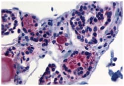 TSHR Rabbit anti-Human, Polyclonal Antibody, Abnova 50 &mu;g | Buy Online | Abnova Corporation | Fisher Scientific