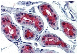 TSHR Rabbit anti-Human, Monkey, Polyclonal Antibody, Abnova 50 &mu;g | Buy Online | Abnova Corporation | Fisher Scientific