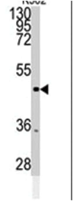 CAMK2G Rabbit anti-Human, Monkey, Mouse, Rat, Polyclonal Antibody, Abnova 400 &mu;L | Buy Online | Abnova Corporation | Fisher Scientific