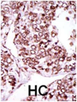 CAMK2G Rabbit anti-Human, Monkey, Mouse, Rat, Polyclonal Antibody, Abnova 400 &mu;L | Buy Online | Abnova Corporation | Fisher Scientific