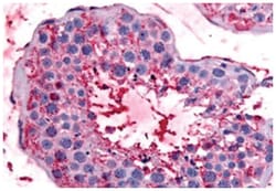 BEST2 Rabbit anti-Bovine, Hamster, Human, Monkey, Mouse, Pig, Rat, Polyclonal Antibody, Abnova 50 &mu;g | Buy Online | Abnova | Fisher Scientific