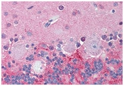 KCNJ6 Rabbit anti-Bovine, Dog, Guinea pig, Hamster, Horse, Human, Monkey, Mouse, Pig, Rabbit, Rat, Polyclonal Antibody, Abnova 50 &mu;g | Buy Online | Abnova Corporation | Fisher Scientific