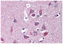KCNA3 Rabbit anti-Human, Polyclonal Antibody, Abnova 50 &mu;g | Buy Online | Abnova Corporation | Fisher Scientific