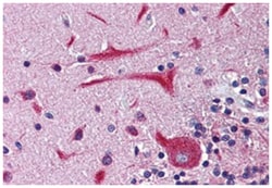 KCNH2 Rabbit anti-Human, Monkey, Mouse, Rat, Polyclonal Antibody, Abnova 50 &mu;g | Buy Online | Abnova Corporation | Fisher Scientific