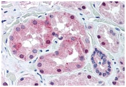 KCNE3 Rabbit anti-Human, Polyclonal Antibody, Abnova 50 &mu;g | Buy Online | Abnova Corporation | Fisher Scientific