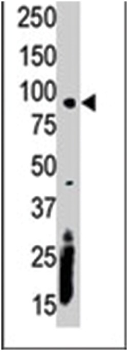 CASK Rabbit anti-Human, Mouse, Polyclonal Antibody, Abnova 400&mu;L; Unlabeled:Antibodies,