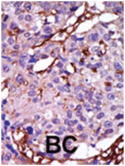 CASK Rabbit anti-Human, Mouse, Polyclonal Antibody, Abnova 400&mu;L; Unlabeled:Antibodies,