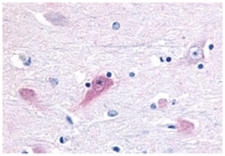 Abnova Corporation RORB Rabbit anti-Bovine, Chicken, Dog, Hamster, Horse, Human, Monkey, Mouse, Rabbit, Rat, Sheep, Polyclonal Antibody, Abnova™