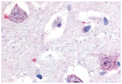 Abnova Corporation RORB Rabbit anti-Human, Polyclonal Antibody, Abnova™