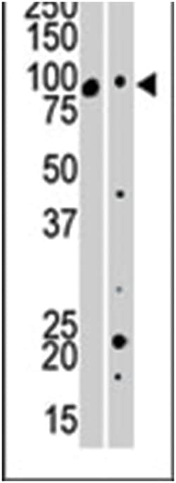 MAP3K12, Rabbit, Polyclonal Antibody, Abnova 400 &mu;L | Buy Online | Abnova Corporation | Fisher Scientific