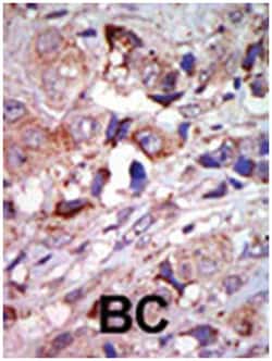 MAP3K12, Rabbit, Polyclonal Antibody, Abnova 400 &mu;L | Buy Online | Abnova Corporation | Fisher Scientific
