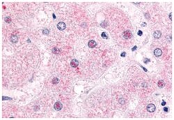 NR0B2, Rabbit, Polyclonal Antibody, Abnova 50 &mu;g | Buy Online | Abnova Corporation | Fisher Scientific
