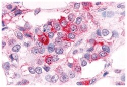 ESRRA Rabbit anti-Bovine, Dog, Hamster, Horse, Human, Monkey, Mouse, Pig, Rat, Polyclonal Antibody, Abnova 50 &mu;g | Buy Online | Abnova Corporation | Fisher Scientific