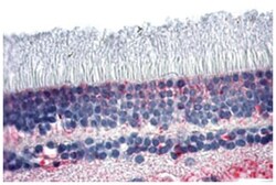 NR2E3 Rabbit anti-Human, Polyclonal Antibody, Abnova 50 &mu;g | Buy Online | Abnova Corporation | Fisher Scientific