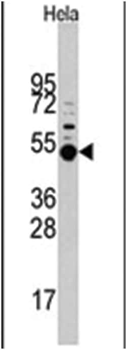 MAPKAPK5, Rabbit anti-Human, Polyclonal Antibody, Abnova 400&mu;L; Unlabeled:Antibodies,