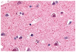 NR4A3 Rabbit anti-Human, Monkey, Polyclonal Antibody, Abnova 50 &mu;g | Buy Online | Abnova Corporation | Fisher Scientific