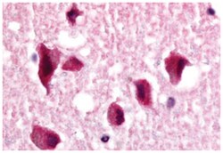 NR2E1, Rabbit, Polyclonal Antibody, Abnova 50 &mu;g | Buy Online | Abnova Corporation | Fisher Scientific
