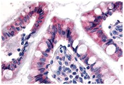 ESRRG Rabbit anti-Bovine, Dog, Hamster, Horse, Human, Monkey, Mouse, Rabbit, Rat, Polyclonal Antibody, Abnova 50 &mu;g | Buy Online | Abnova Corporation | Fisher Scientific