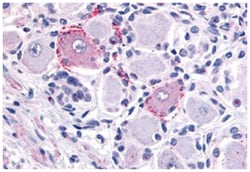 TRPV2 Rabbit anti-Human, Polyclonal Antibody, Abnova 50 &mu;g | Buy Online | Abnova Corporation | Fisher Scientific