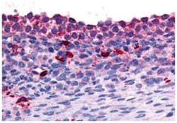 NR4A1 Rabbit anti-Human, Polyclonal Antibody, Abnova 50 &mu;g | Buy Online | Abnova Corporation | Fisher Scientific