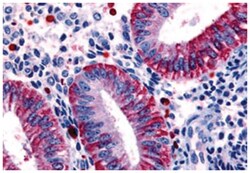 DKK1 Rabbit anti-Horse, Human, Monkey, Pig, Polyclonal Antibody, Abnova 50 &mu;g | Buy Online | Abnova Corporation | Fisher Scientific