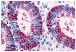 DKK1 Rabbit anti-Human, Polyclonal Antibody, Abnova 50 &mu;g | Buy Online | Abnova Corporation | Fisher Scientific
