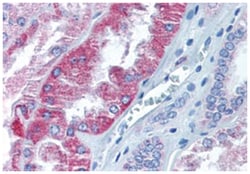 AADAT Rabbit anti-Human, Polyclonal Antibody, Abnova 50 &mu;g | Buy Online | Abnova Corporation | Fisher Scientific