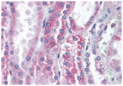 TRPV1 Rabbit anti-Guinea pig, Human, Polyclonal Antibody, Abnova 50 &mu;g | Buy Online | Abnova Corporation | Fisher Scientific