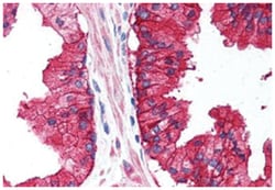 CD38 Rabbit anti-Human, Monkey, Polyclonal Antibody, Abnova 50 &mu;g | Buy Online | Abnova Corporation | Fisher Scientific