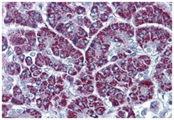 P2RX3, Rabbit, Polyclonal Antibody, Abnova 50 &mu;g | Buy Online | Abnova | Fisher Scientific