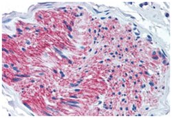 P2RX7, Rabbit, Polyclonal Antibody, Abnova 50 &mu;g | Buy Online | Abnova Corporation | Fisher Scientific